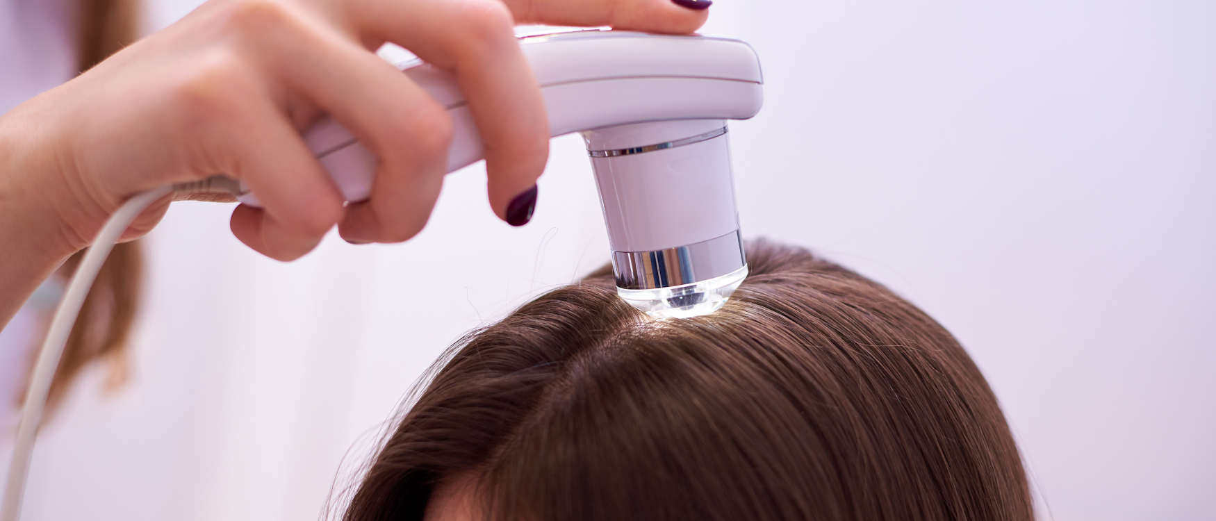 Tratamiento De La Psoriasis Del Cuero Cabelludo En Madrid