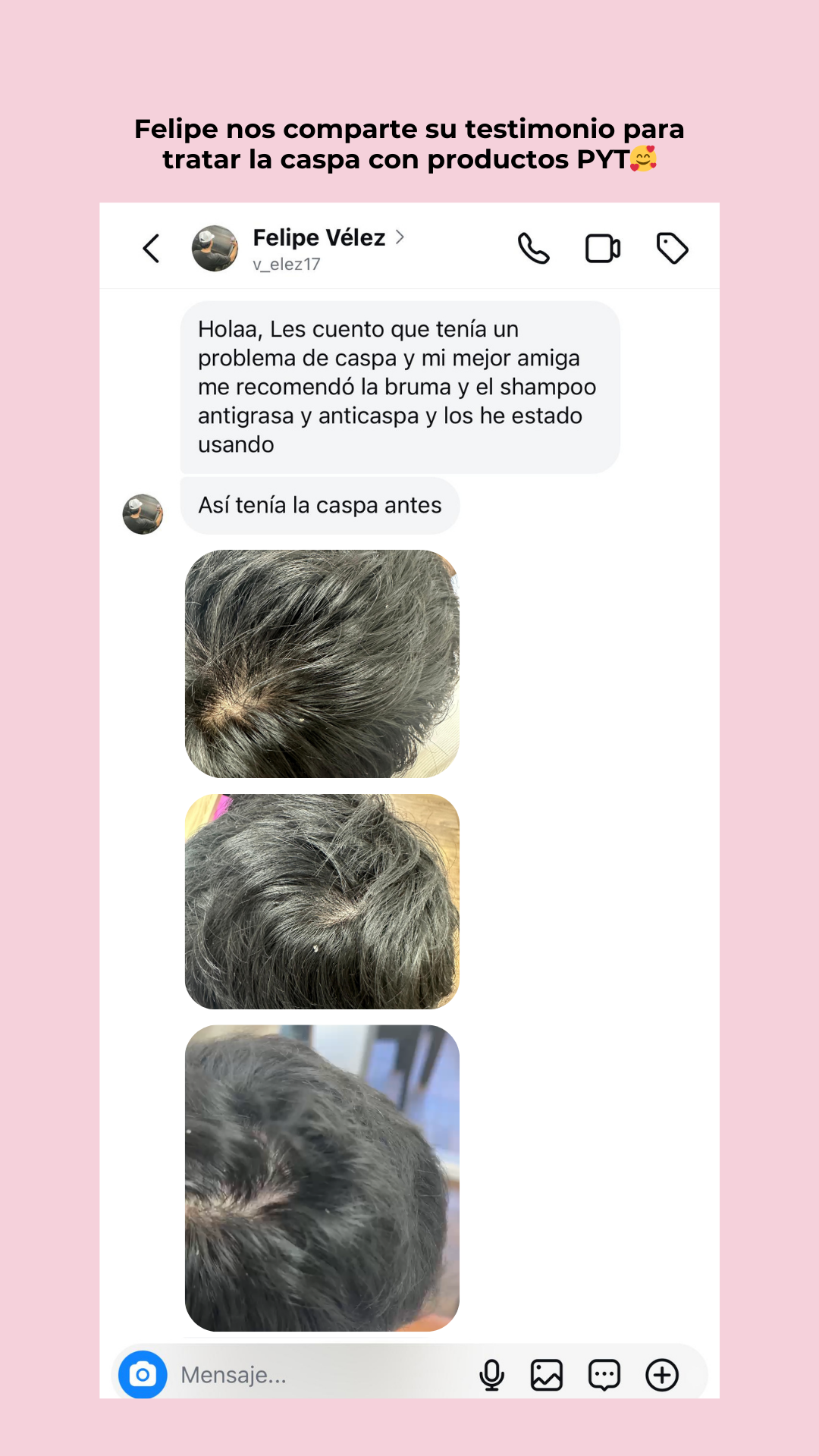 Kit Detox Capilar + Hidratación
