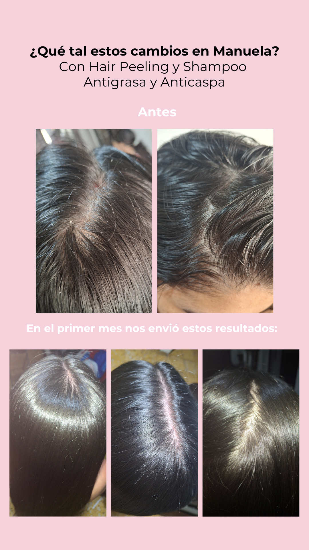 Kit Detox Capilar + Hidratación
